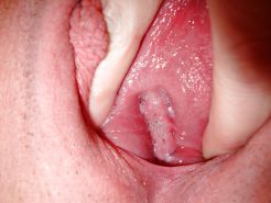 Greek orgy tgp Sideways pee hole