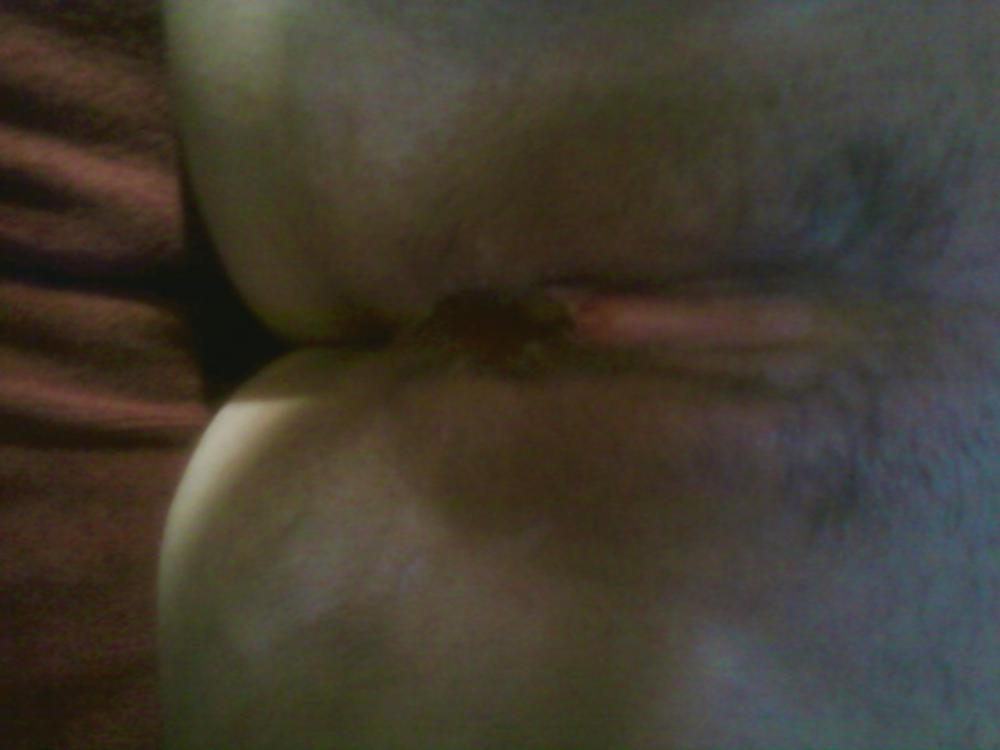 Anal whore #9901263