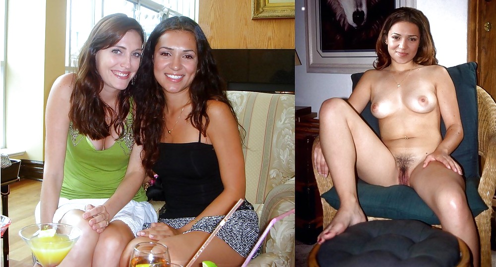 Before after 370. #4525923