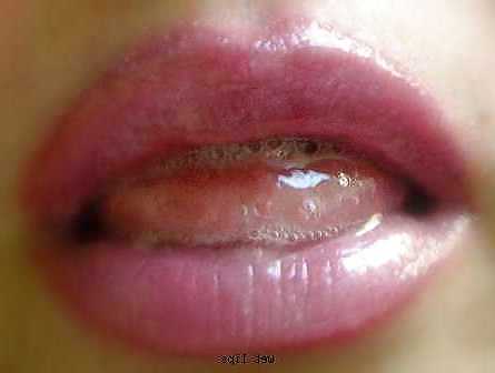 Labios
 #3046821