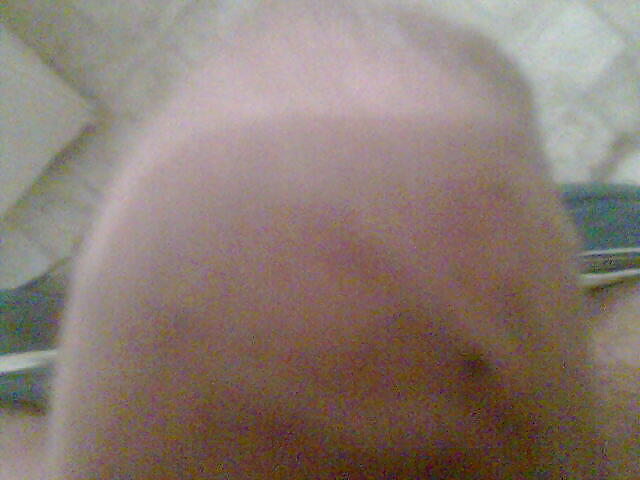 My pene #17094485