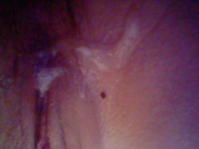 私の穴
 #10643943