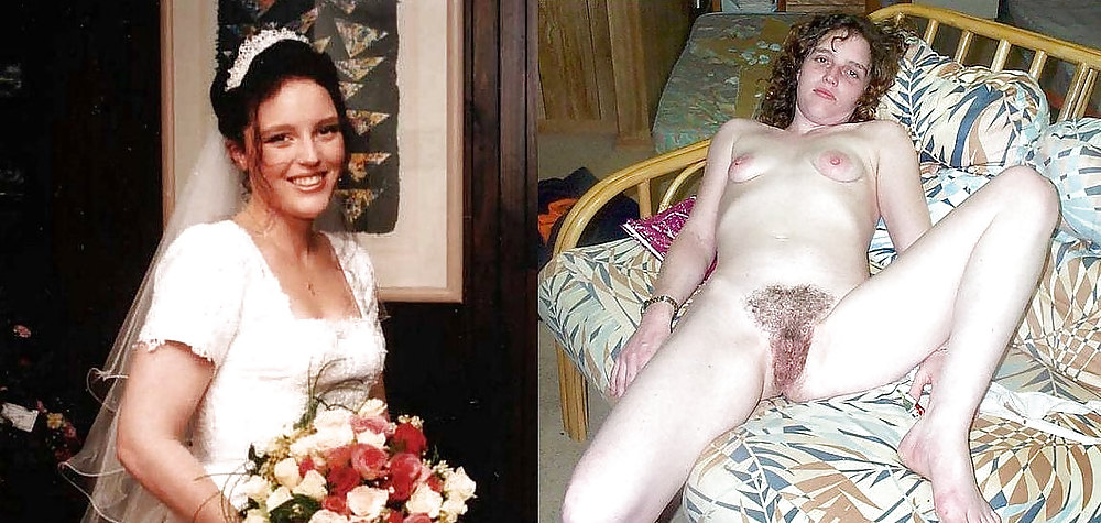 Before after 296. #3592522