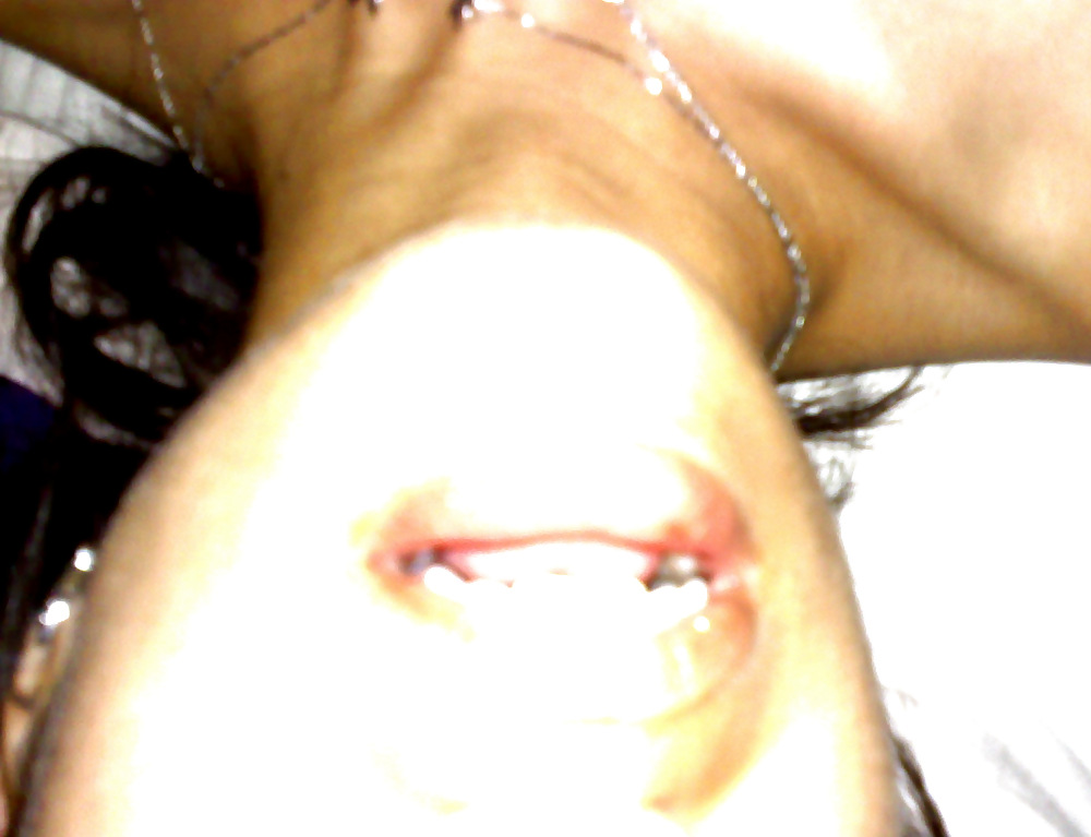 Candy Component #9929396