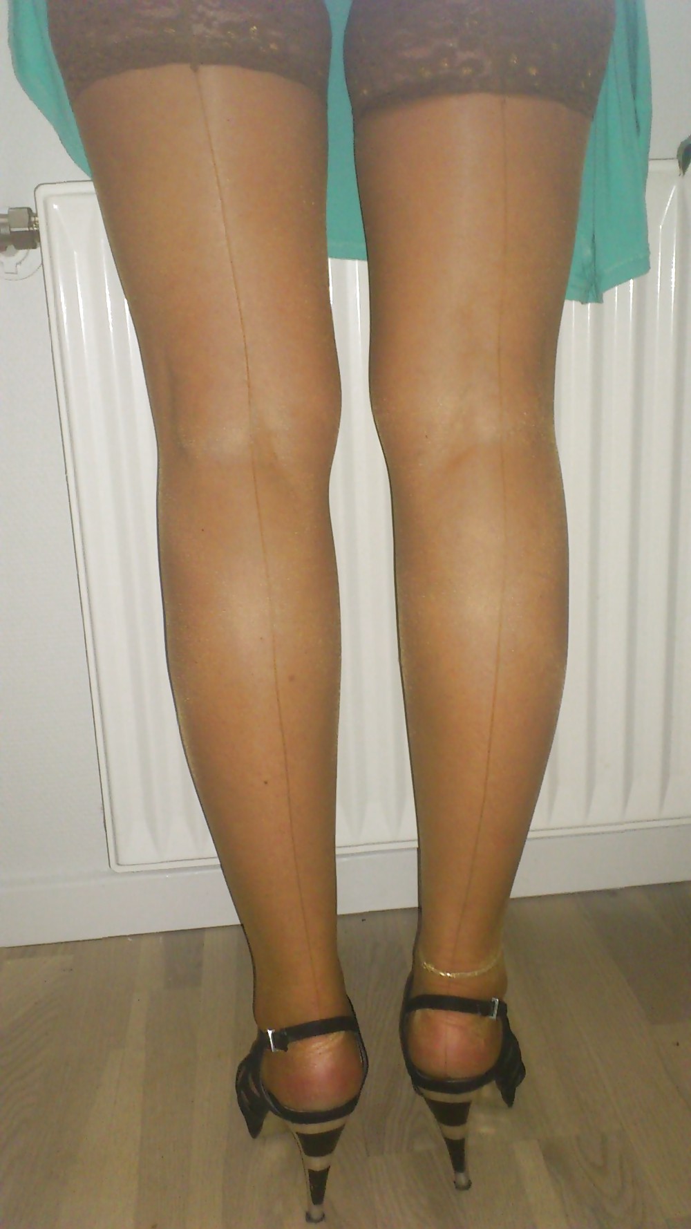 She obtained legs #9727979