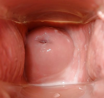 My wife's cervix #4923236