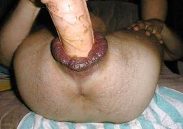 Prolapse Porn Pics, XXX Photos, Sex Images Page 2 - PICTOA.COM