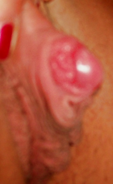 Wachsende Klitoris Und Lippen Wie Zucker #7164487