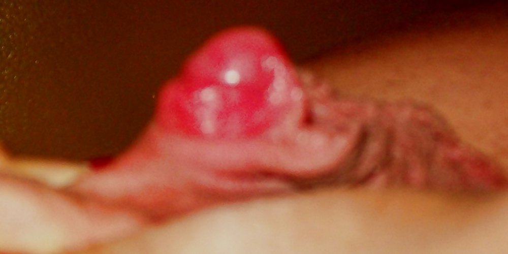 Wachsende Klitoris Und Lippen Wie Zucker #7164543
