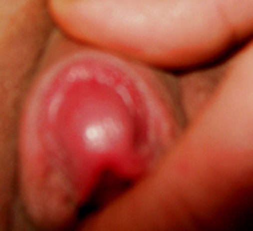 Wachsende Klitoris Und Lippen Wie Zucker #7164606