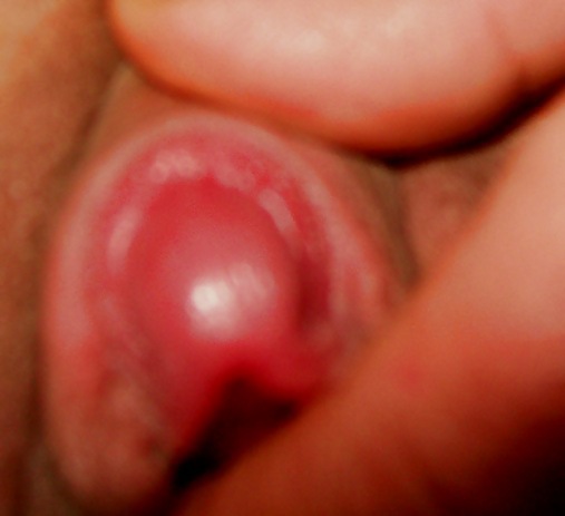 Clítoris creciente y labios como el azúcar
 #7164606