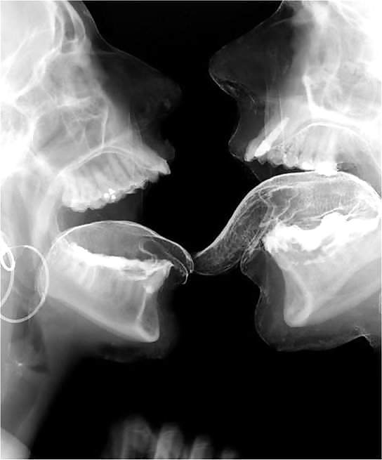 X ray sex #8799059