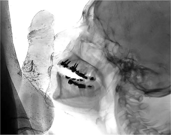 X ray sex #8799063