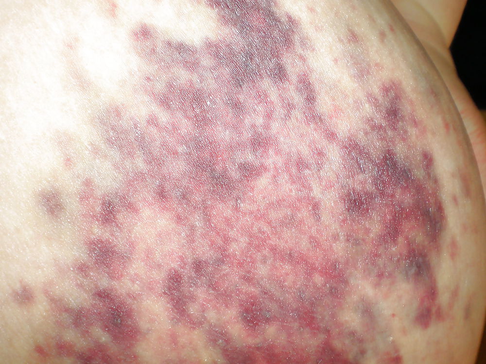 After yesterday... #4538835