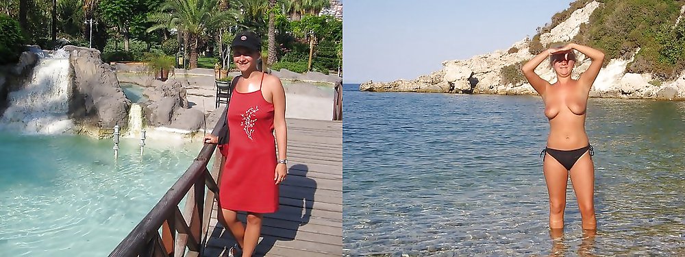 Before-After 224. #4320772