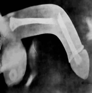 Ich Finde, Lustig ... :) #20086345