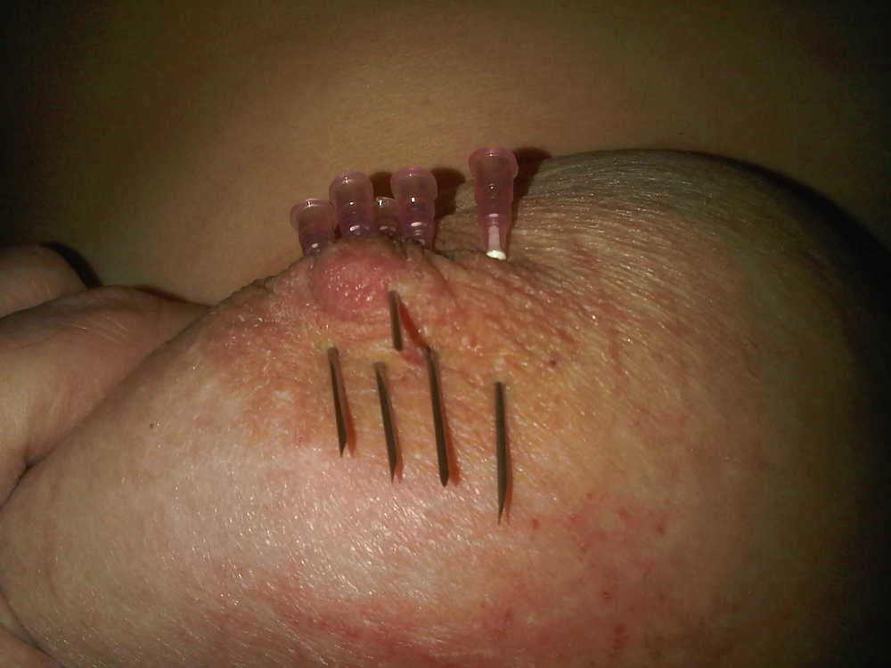 Scottish slut with tortured tits! #3964558