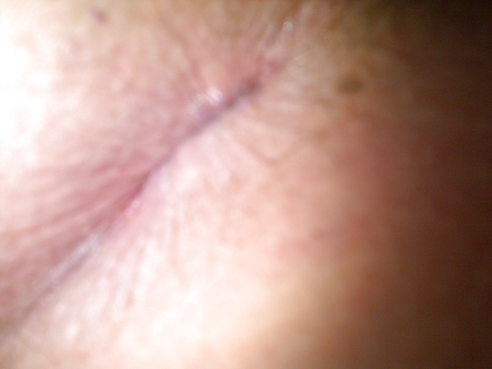 My ass hole and my small cock #4139805