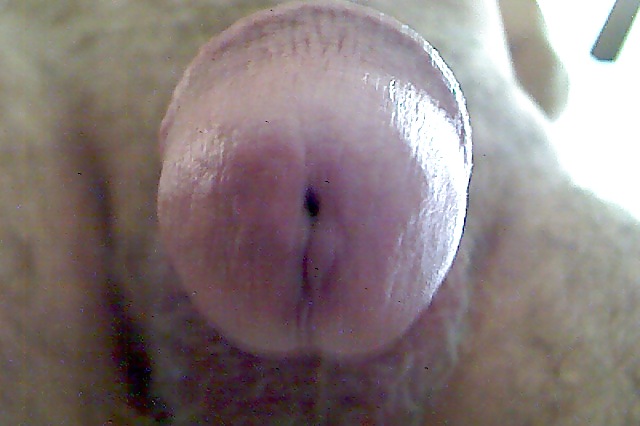 Up close #13899306