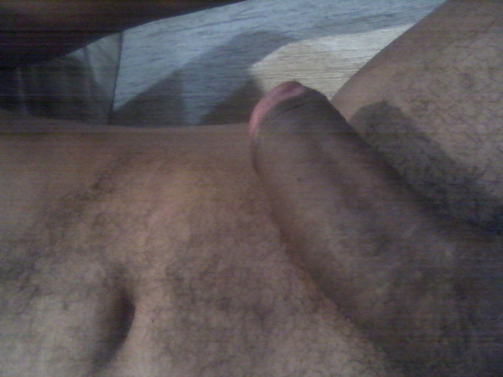 My toe #17764344
