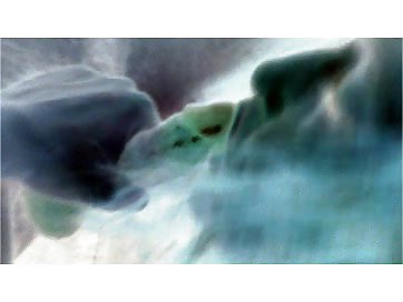 001
 #22730618