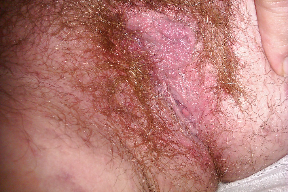 The final hairy pics