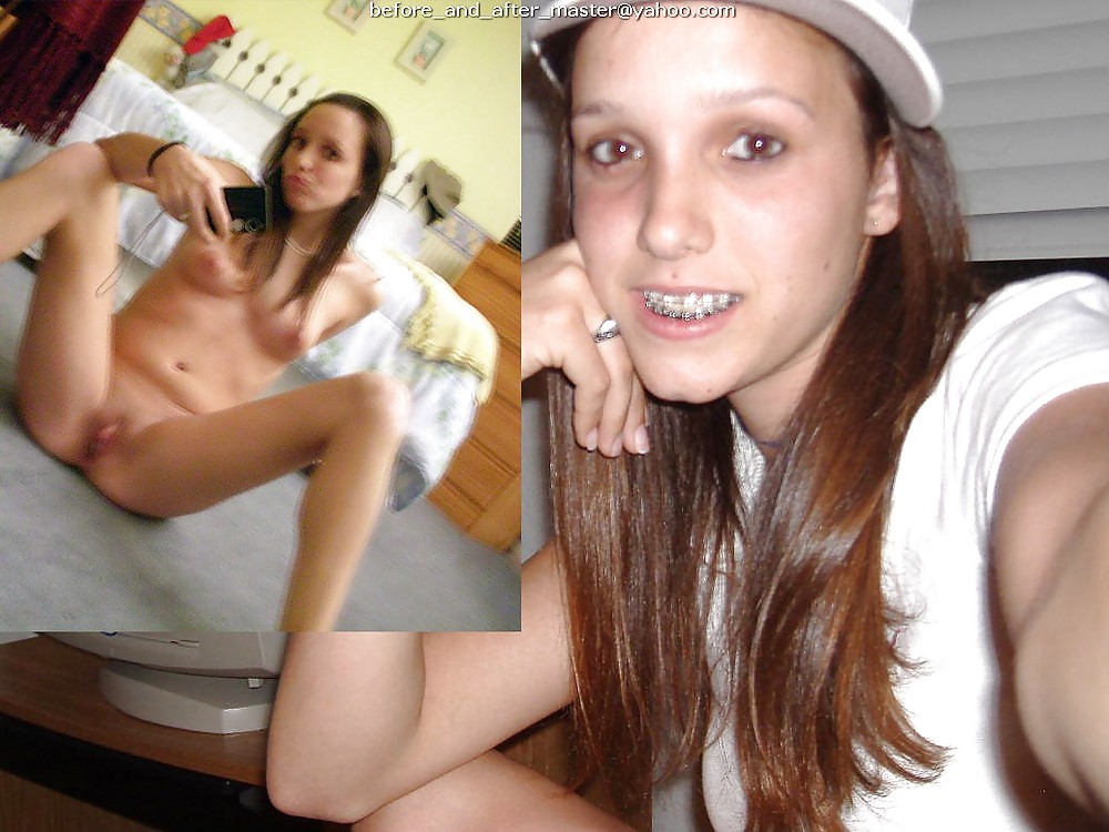 Prima e dopo le foto - adolescenti
 #1451931