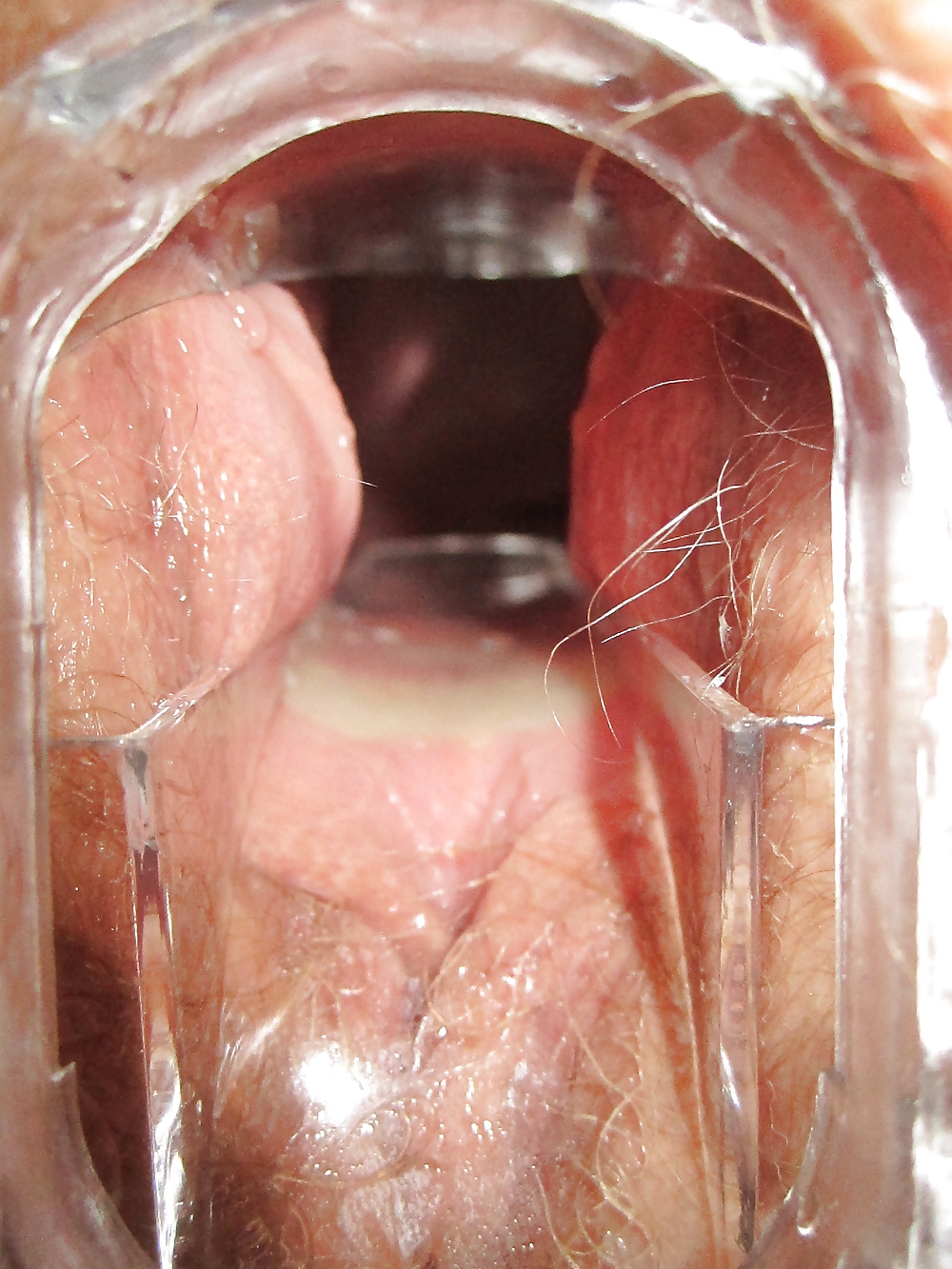 Speculum #9373374
