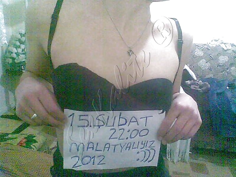 Malatyali cift #9311317