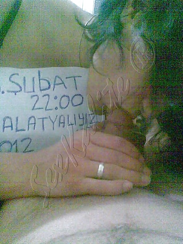 Malatyali cift #9311345