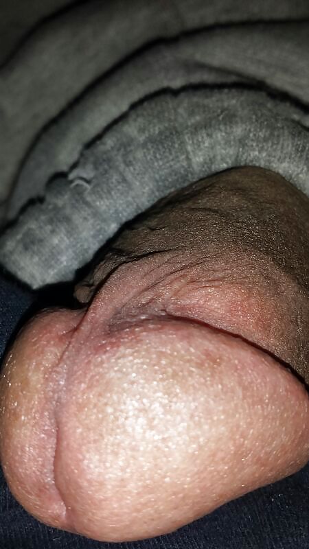 ハード
 #22303779