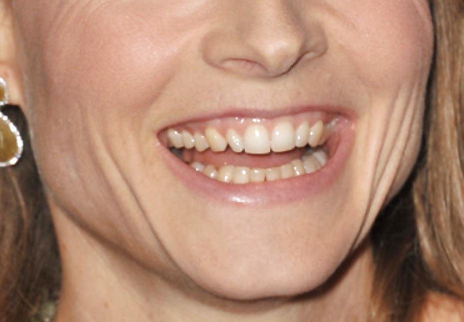 La bocca femminile
 #6577286