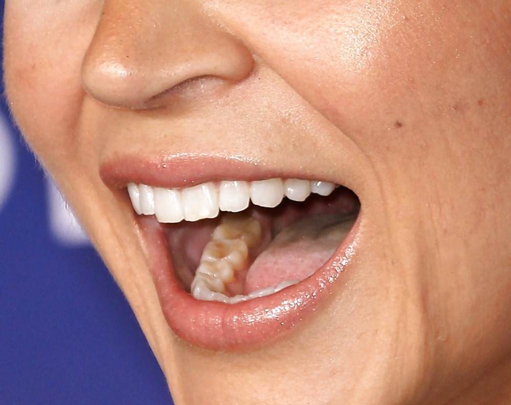 La bocca femminile
 #6577774