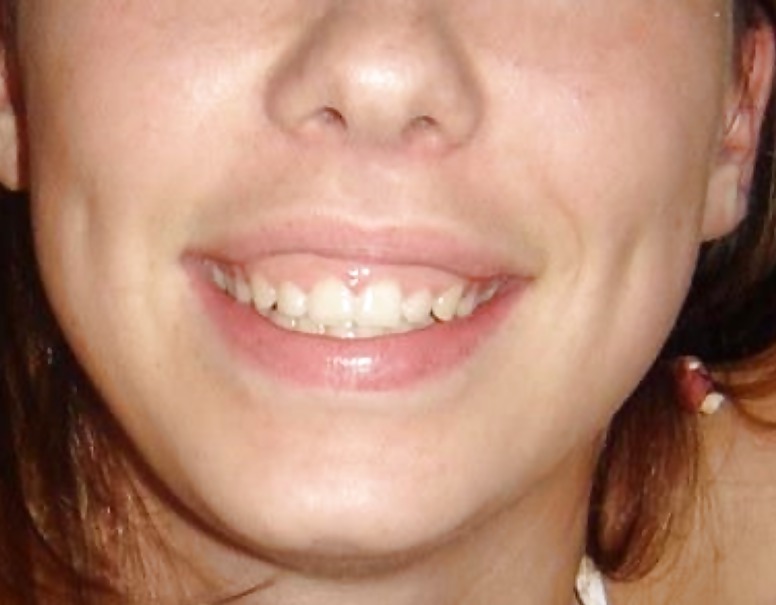 La bocca femminile
 #6578741