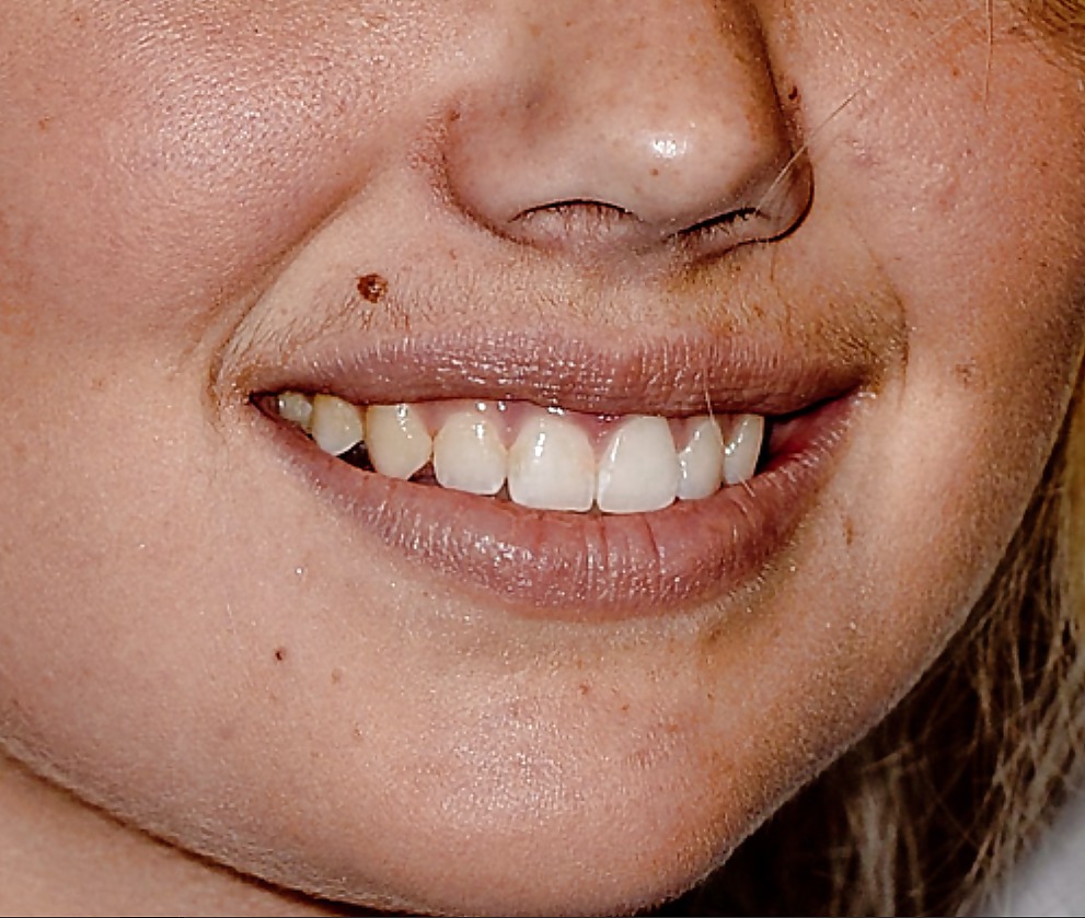 La bocca femminile
 #6578759