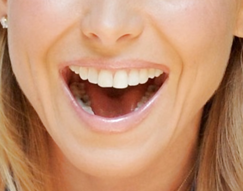 La bocca femminile
 #6578868