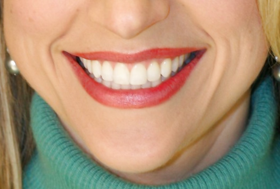 La bocca femminile
 #6579119