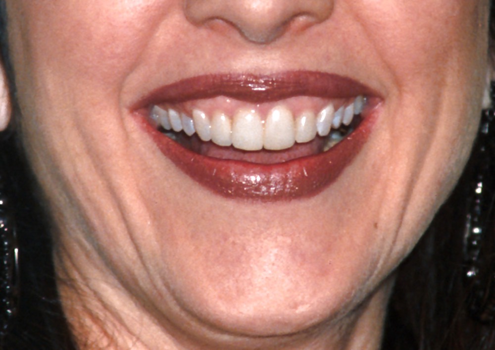 La bocca femminile
 #6579264