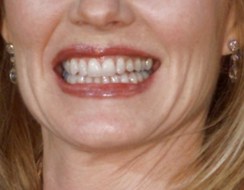 La bocca femminile
 #6579468