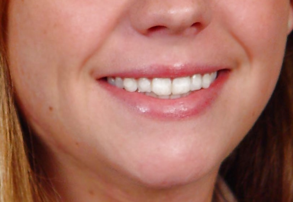 La bocca femminile
 #6580201