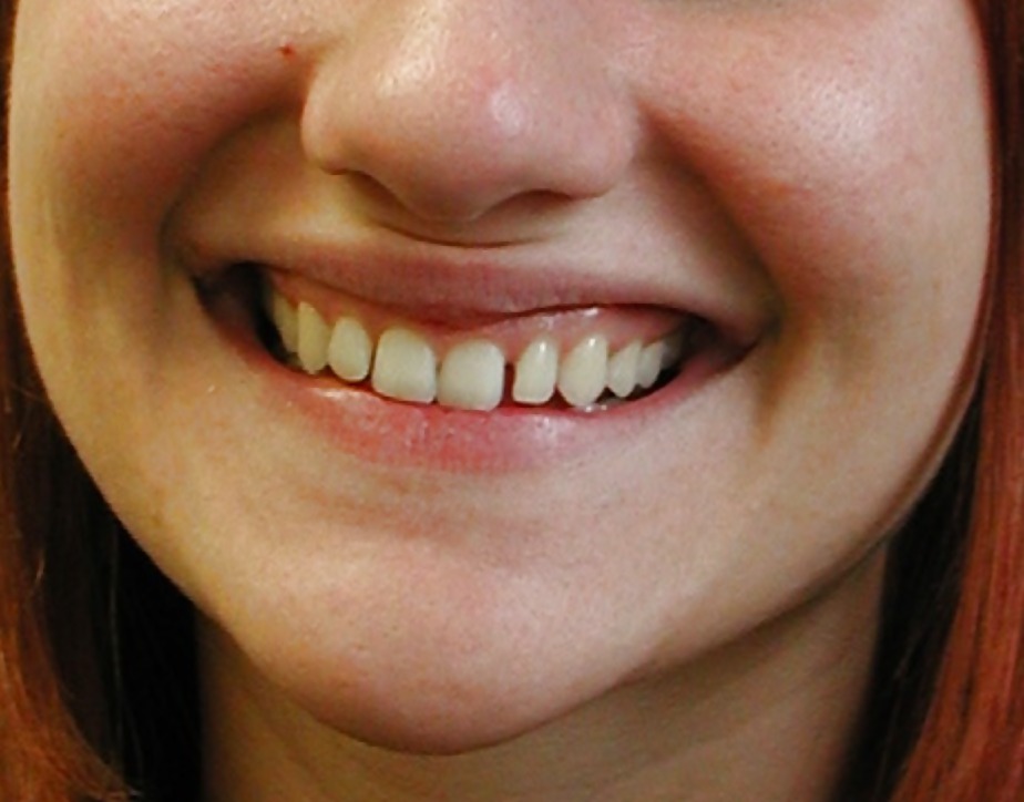 La bocca femminile
 #6580207