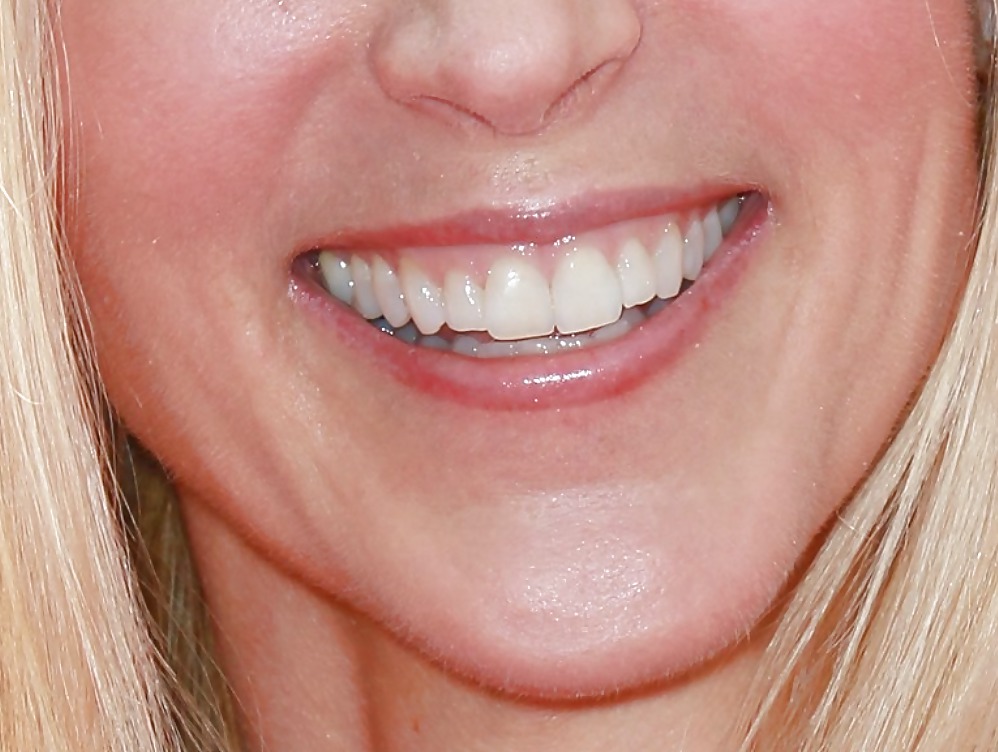 La bocca femminile
 #6580277