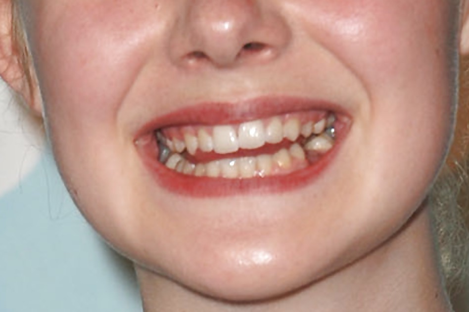 La bocca femminile
 #6580953
