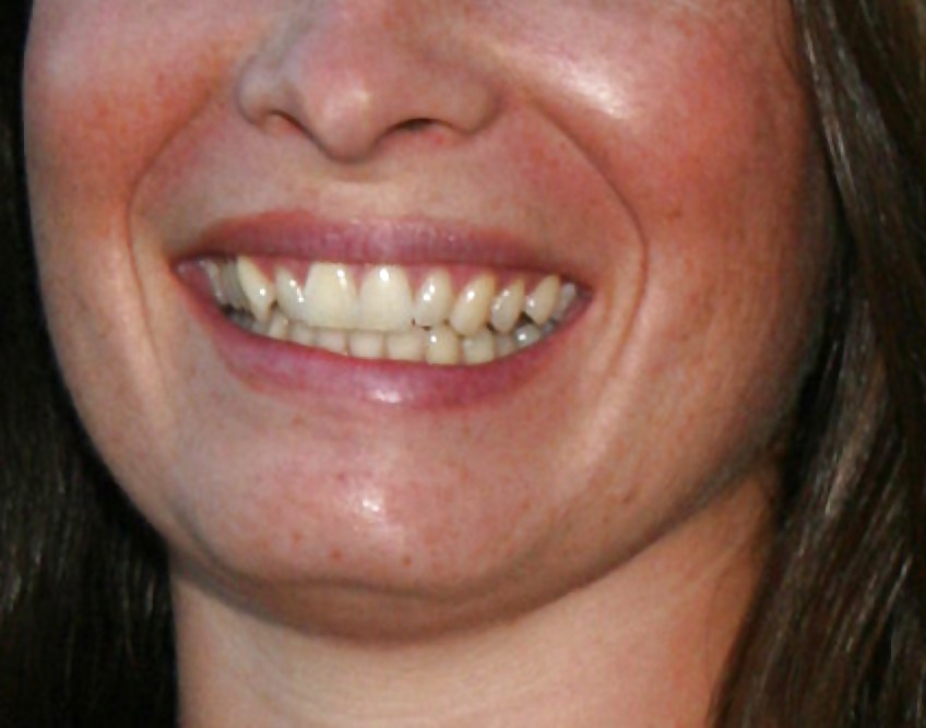 La bocca femminile
 #6580981