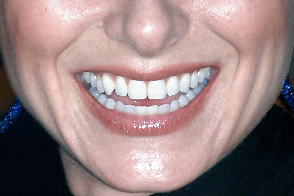 La bocca femminile
 #6581131