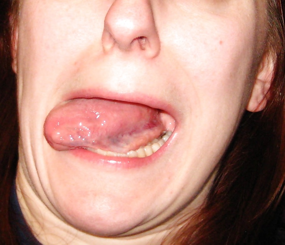 The female mouth #6581248