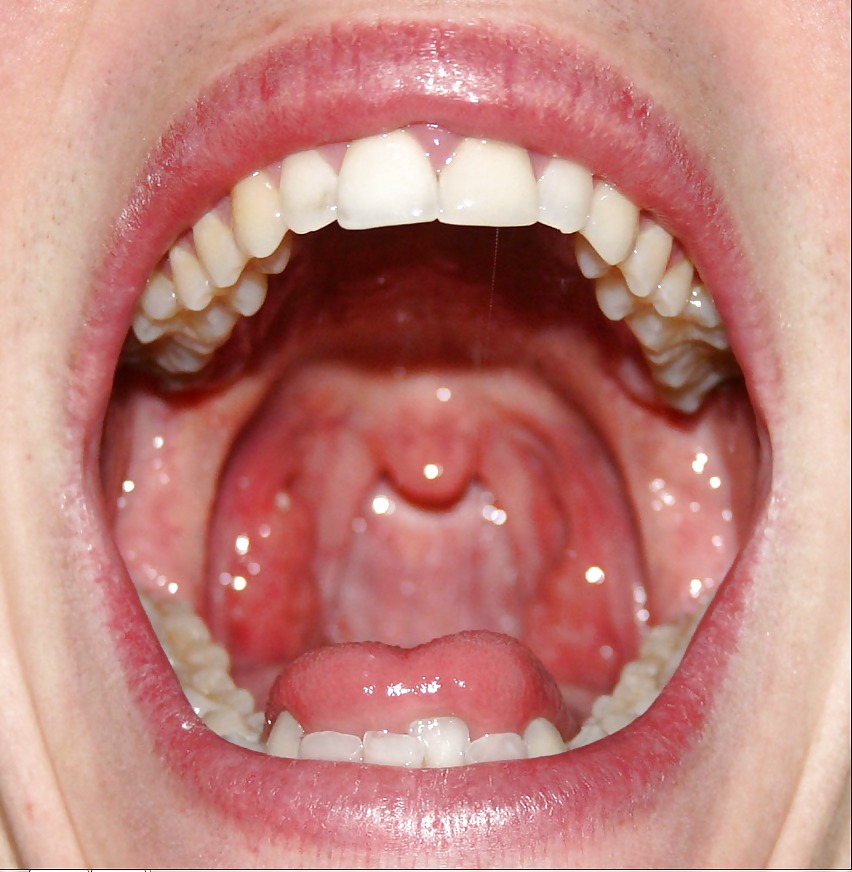 The female mouth #6581254