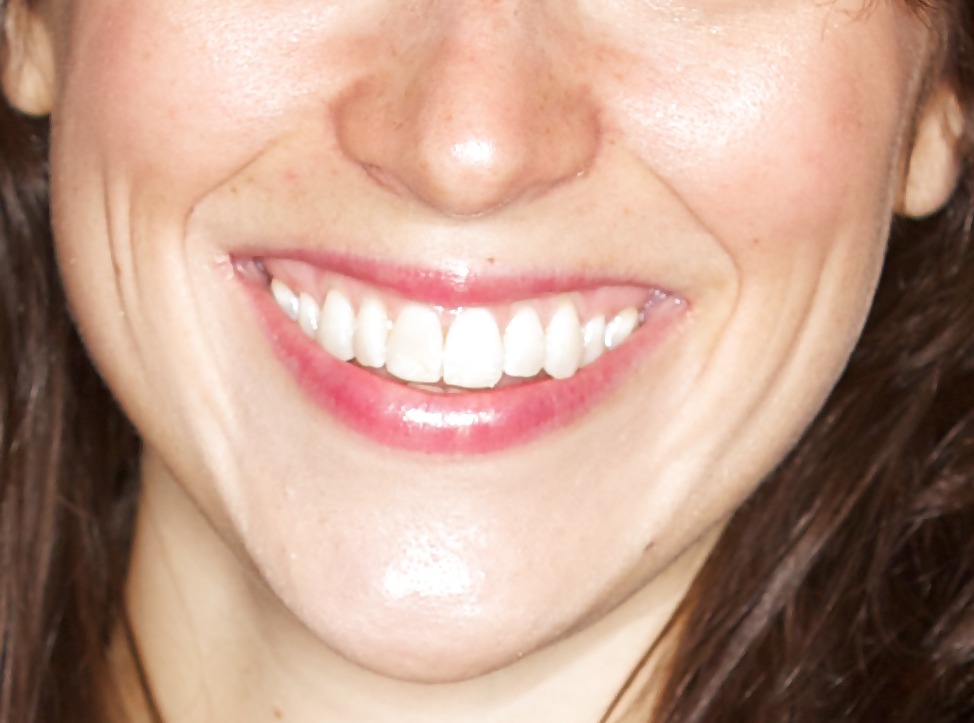 La bocca femminile
 #6581445