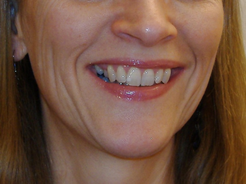 La bocca femminile
 #6581450