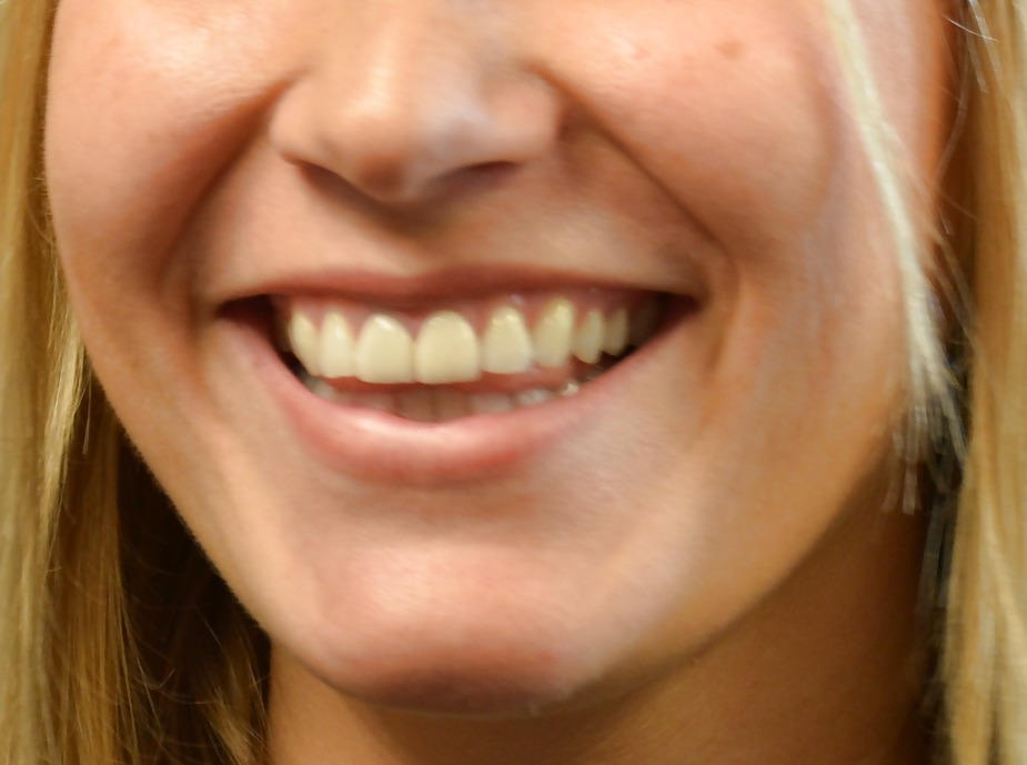 La bocca femminile
 #6581490